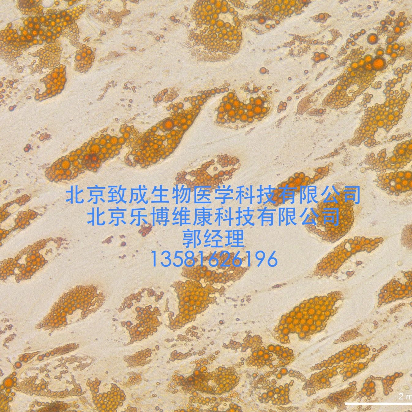 干細胞成脂或成骨誘導分化