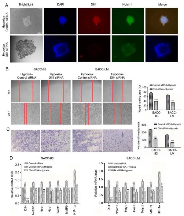低氧/厌氧产品案例——涎腺肿瘤