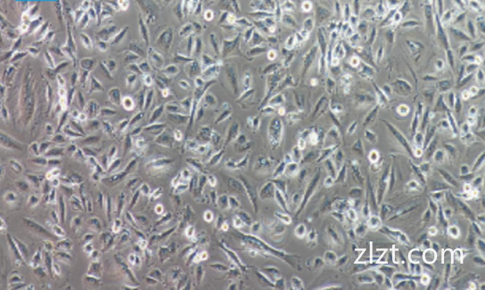 NCI-H69/人小细胞肺癌细胞