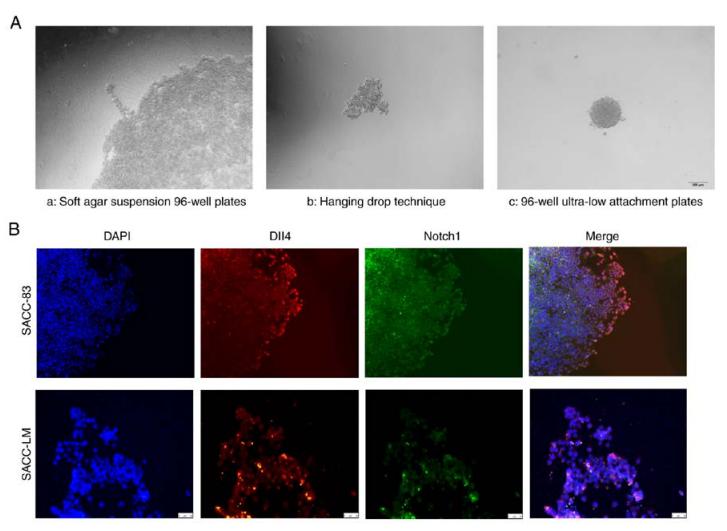 低氧/厌氧产品案例——涎腺肿瘤