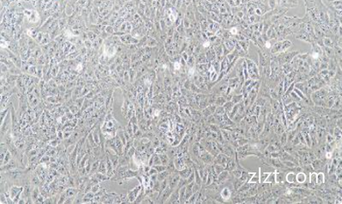 JM (人T淋巴细胞白血病细胞) (STR鉴定正确)