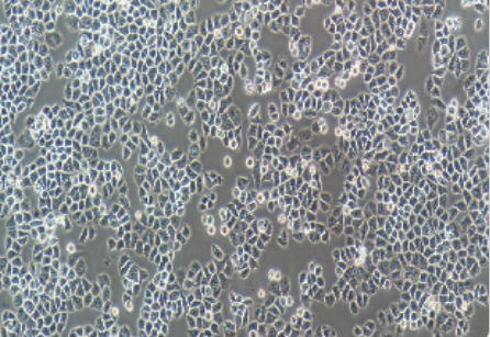 NCI-H69/人小细胞肺癌细胞