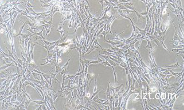 JM (人T淋巴细胞白血病细胞) (STR鉴定正确)