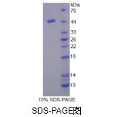 蛋白C抑制因子(PCI)重组蛋白