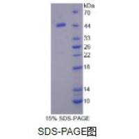 蛋白C抑制因子(PCI)重组蛋白