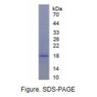 真核翻译起始因子4E结合蛋白1(EIF4EBP1)重组蛋白