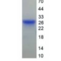 凝溶胶蛋白(GSN)重组蛋白