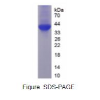 非受体型蛋白酪氨酸磷酸酶1(PTPN1)重组蛋白