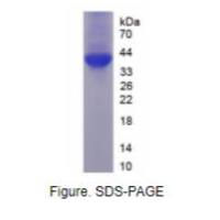 非受体型蛋白酪氨酸磷酸酶1(PTPN1)重组蛋白