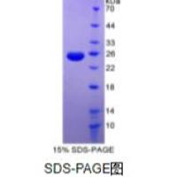 肿瘤坏死因子相关配体分子1A(TL1A)重组蛋白