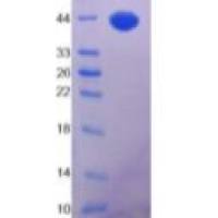 胰岛素样生长因子1(IGF1)重组蛋白