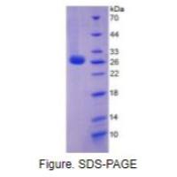 白介素6(IL6)重组蛋白
