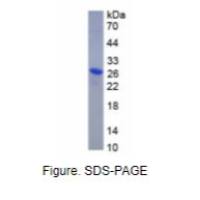 结合珠蛋白(Hpt)重组蛋白