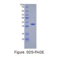 分泌性白细胞蛋白酶抑制因子(SLPI)重组蛋白
