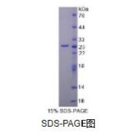 基质金属蛋白酶2(MMP2)重组蛋白