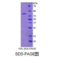嘌呤能受体P2X7(P2RX7)重组蛋白