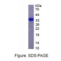 肿瘤调节蛋白(TR)重组蛋白