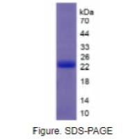干扰素τ(IFNt)重组蛋白