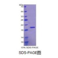 RNA结合基元蛋白20(RBM20)重组蛋白