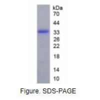 核因子κB受体激活因子配体(RANkL)活性蛋白