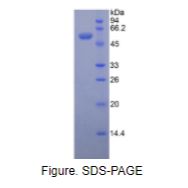 外核苷酸焦磷酸酶/磷酸二酯酶1(ENPP1)重组蛋白