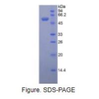 外核苷酸焦磷酸酶/磷酸二酯酶1(ENPP1)重组蛋白