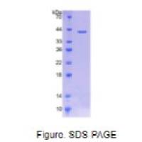 胆碱转运蛋白样蛋白1(CTL1)重组蛋白