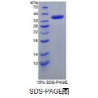 运动神经元生存蛋白1(SMN)重组蛋白
