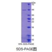 亚铁螯合酶(FECH)重组蛋白
