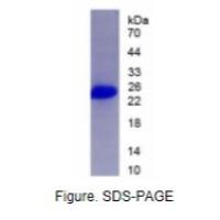 干扰素β(IFNb)活性蛋白
