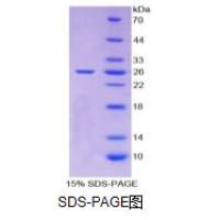 组织金属蛋白酶抑制因子3(TIMP3)重组蛋白