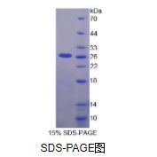 尿溶蛋白3A(UPK3A)重组蛋白