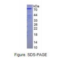 PAI-1/tPA复合物(tPA/PAI1)重组蛋白