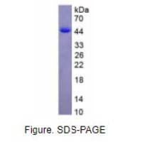 白介素12B(IL12B)活性蛋白