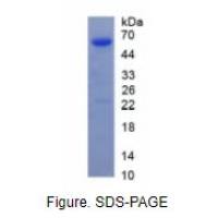 心肌肌钙蛋白T(TNNT2)重组蛋白