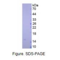 心型脂肪酸结合蛋白(H-FABP)天然蛋白