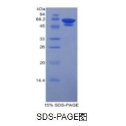 糖化血红蛋白A1c(HbA1c)天然蛋白