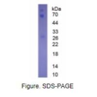 免疫球蛋白A(IgA)天然蛋白