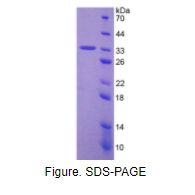 肿瘤蛋白p53(P53)活性蛋白