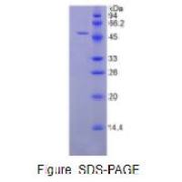 脂蛋白关联磷脂酶A2(LpPLA2)活性蛋白