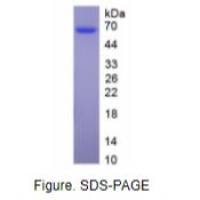 抗凝血酶(AT)天然蛋白