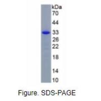 Ⅰ型前胶原氨基端原肽(PINP)真核蛋白