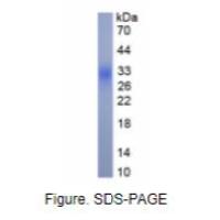 干扰素β(IFNb)真核蛋白