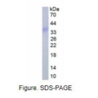 趋化因子C-X-C-基元配体16(CXCL16)真核蛋白