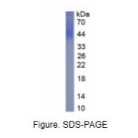 CD86分子(CD86)真核蛋白
