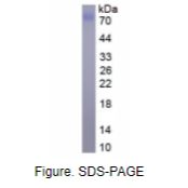 CD14分子(CD14)真核蛋白