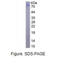CD14分子(CD14)真核蛋白