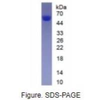 血管紧张素原(AGT)真核蛋白