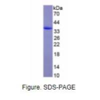 膜联蛋白A5(ANXA5)真核蛋白