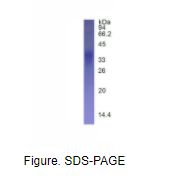 免疫球蛋白关联β(CD79B)真核蛋白